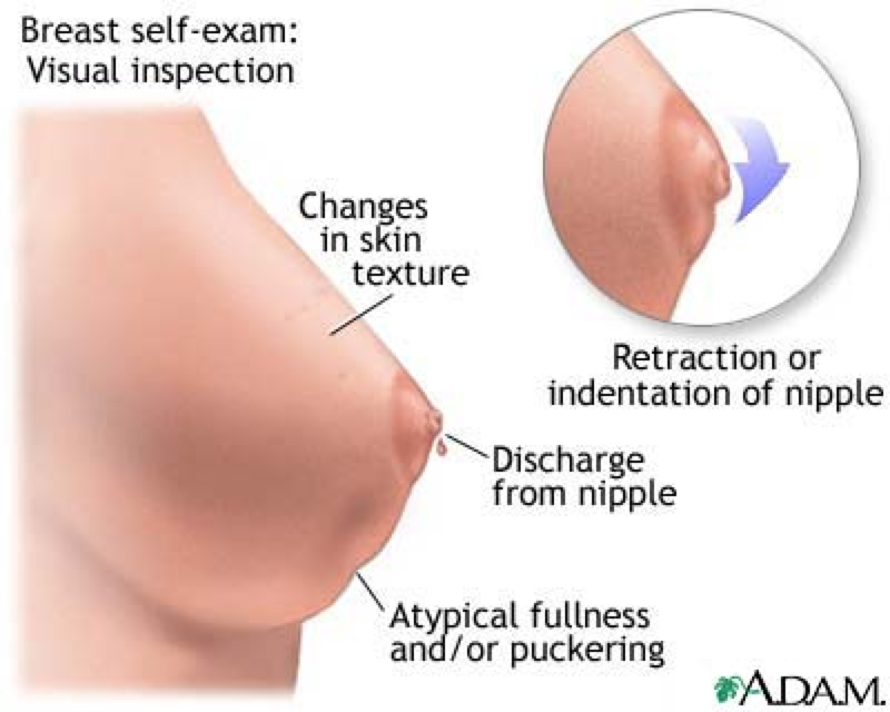 breast examination 3